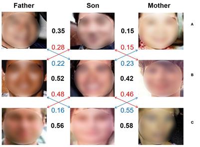 ACLMHA and FML: A brain-inspired kinship verification framework